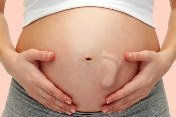 Анализ на синдром дауна у беременных