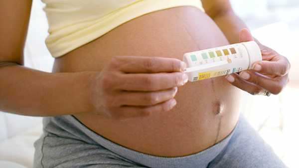 Каким цветом моча при беременности на ранних сроках