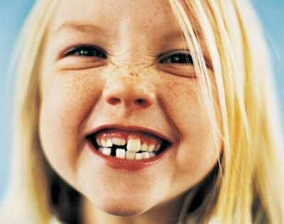 Кривые зубы у детей 7 лет фото