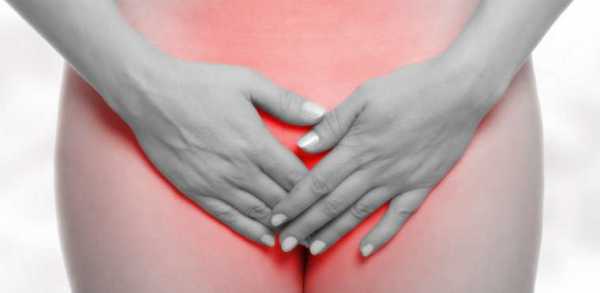 Молочница у женщин причины появления и симптомы